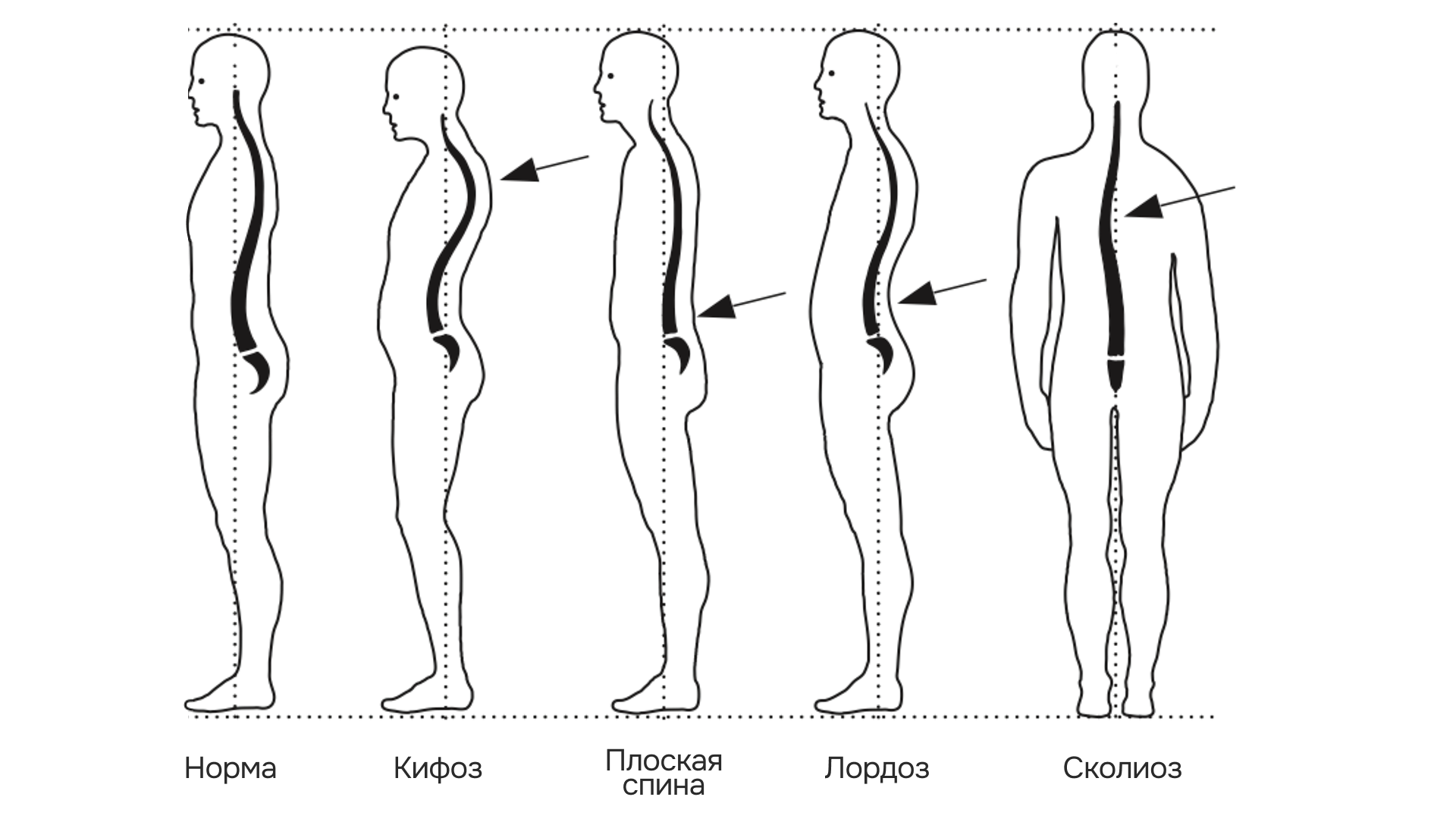 -#0020 {1920x1080}: (posture-types.png) [типы осанки]