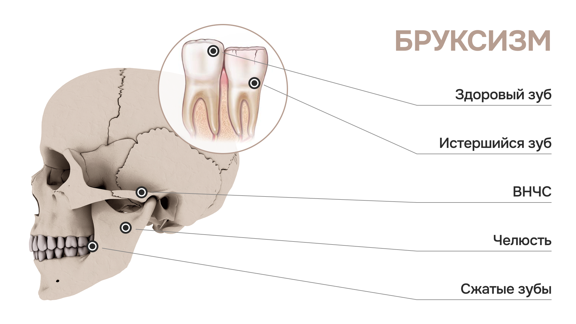 -#0010 {1920x1080}: (bruxism.png) [бруксизм]