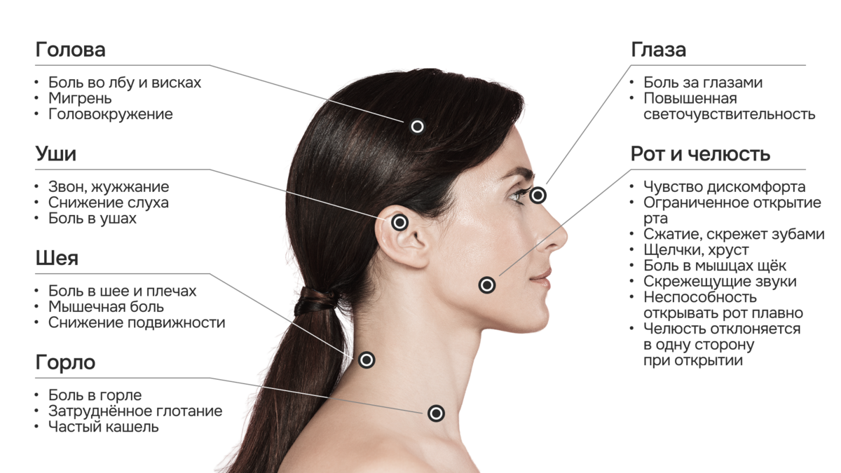 -#0010 {1200x675}: (head-pain.png) [локализация боли при дисфункции внчс]