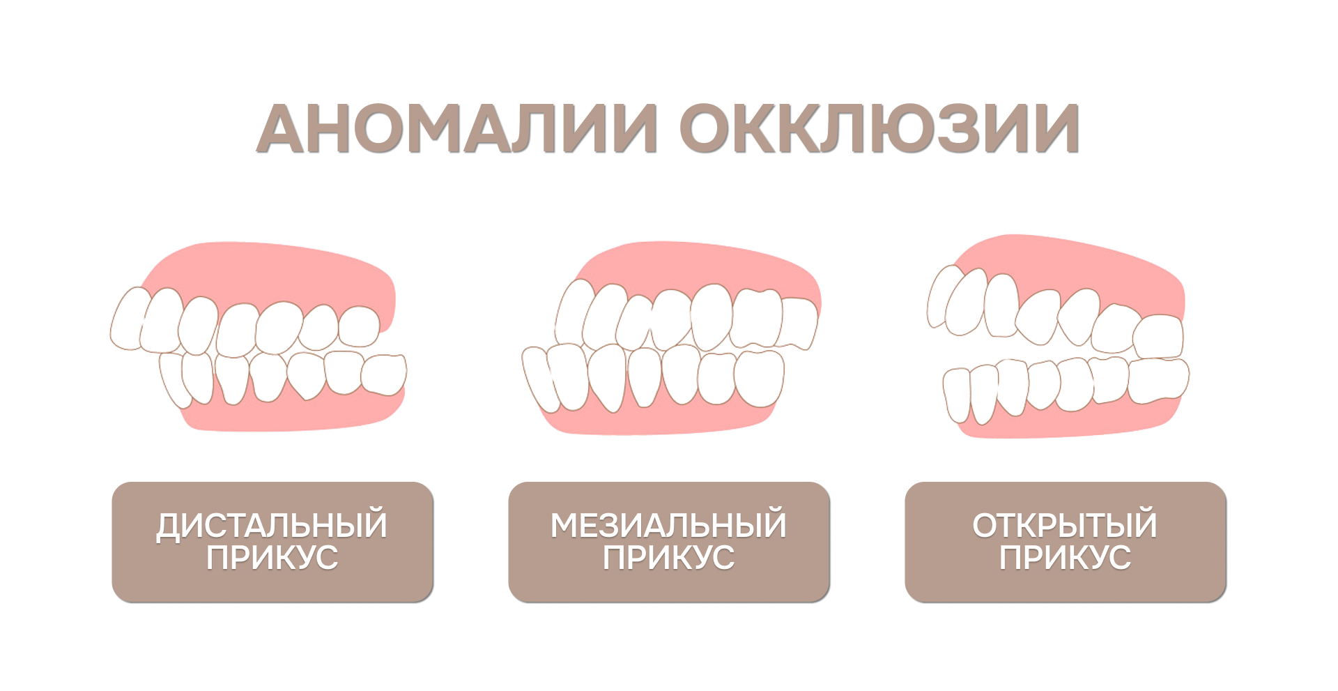 -#0020 {1920x991}: (occlusion-anomaly.png) [аномалии окклюзии, типы прикуса]