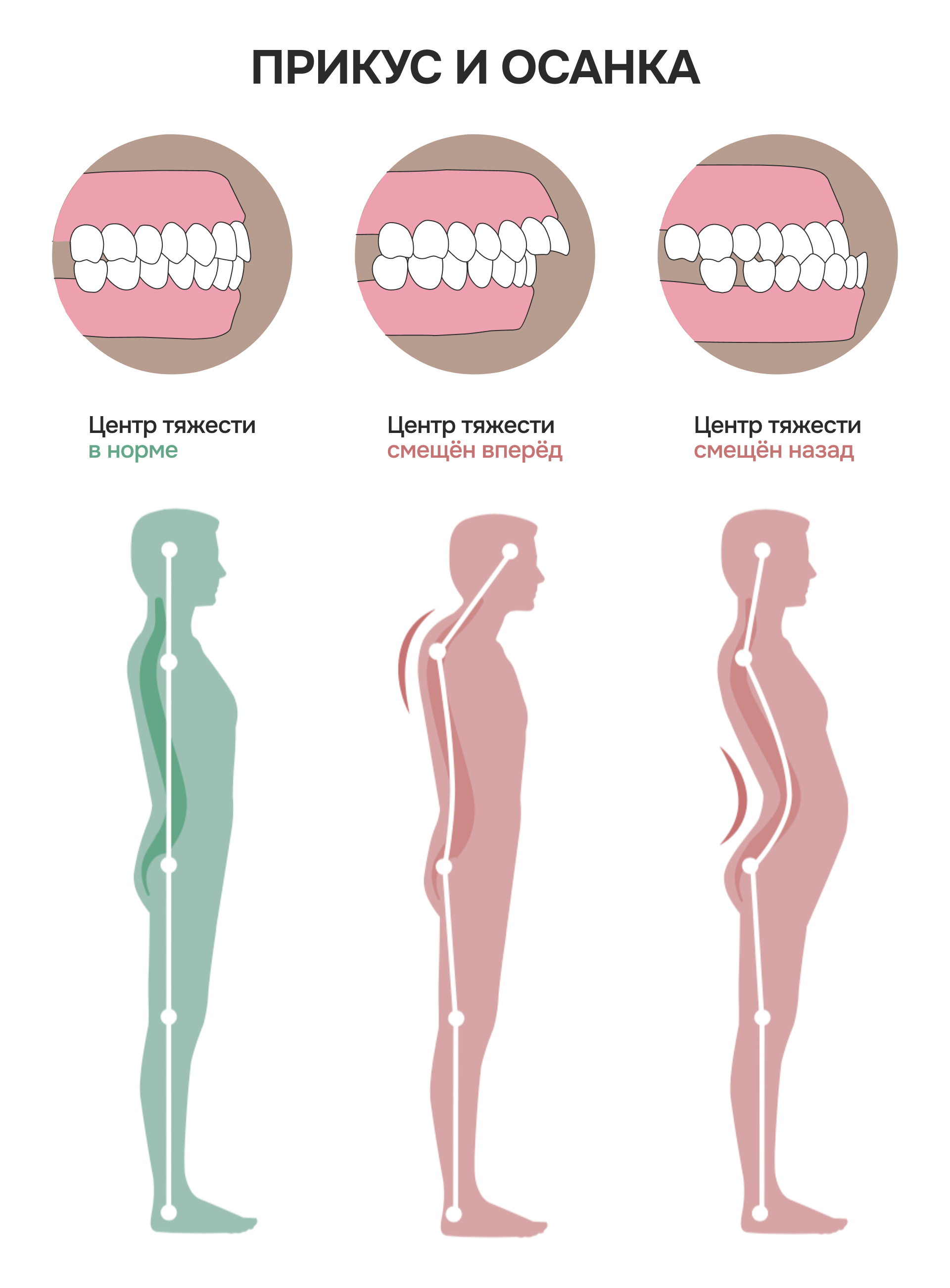 -#0020 {1920x2603}: (osteo-v-stoma-4.png) 
