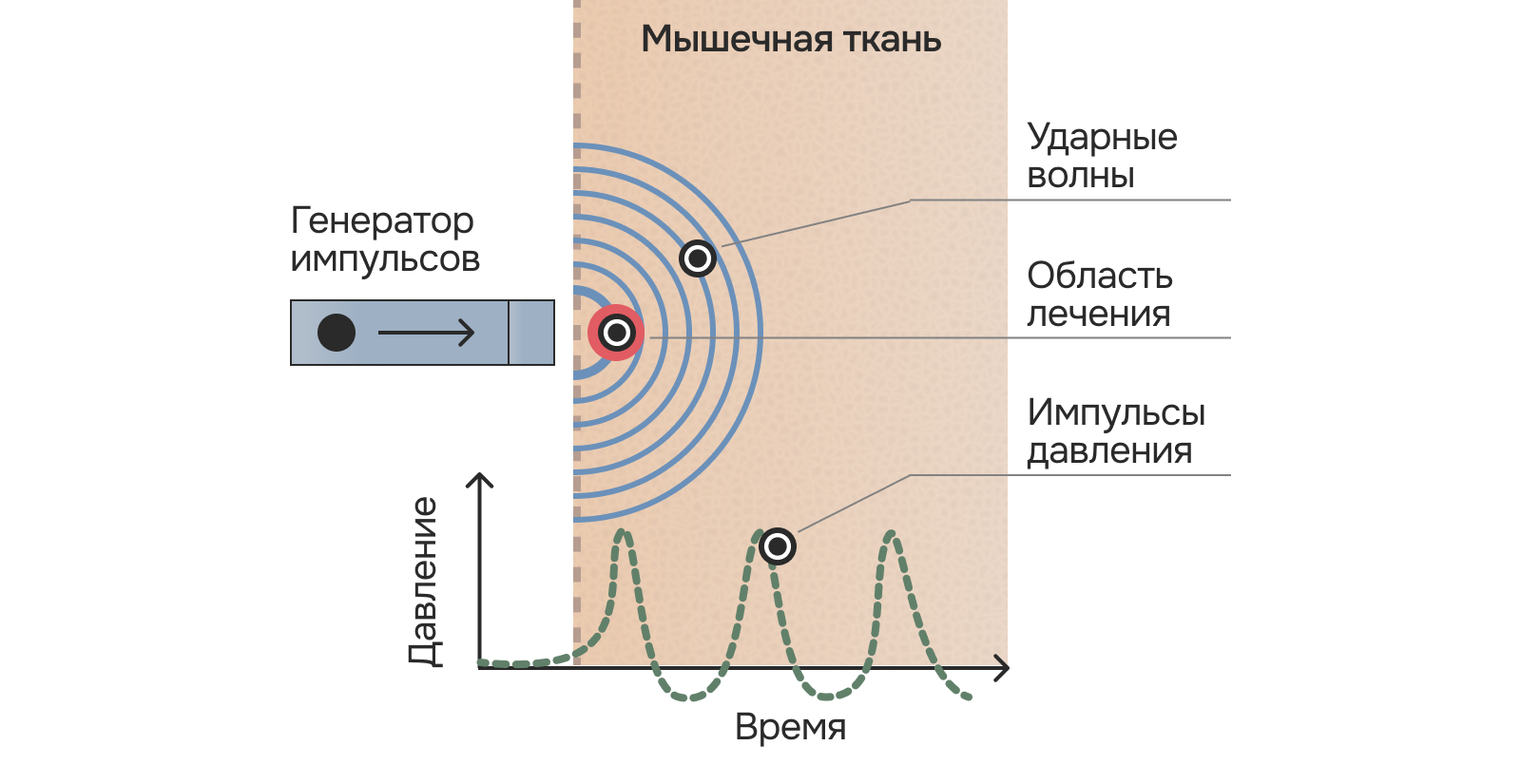 -#0030 {1600x825}: (uvt-scheme.png) [принцип работы увт]
