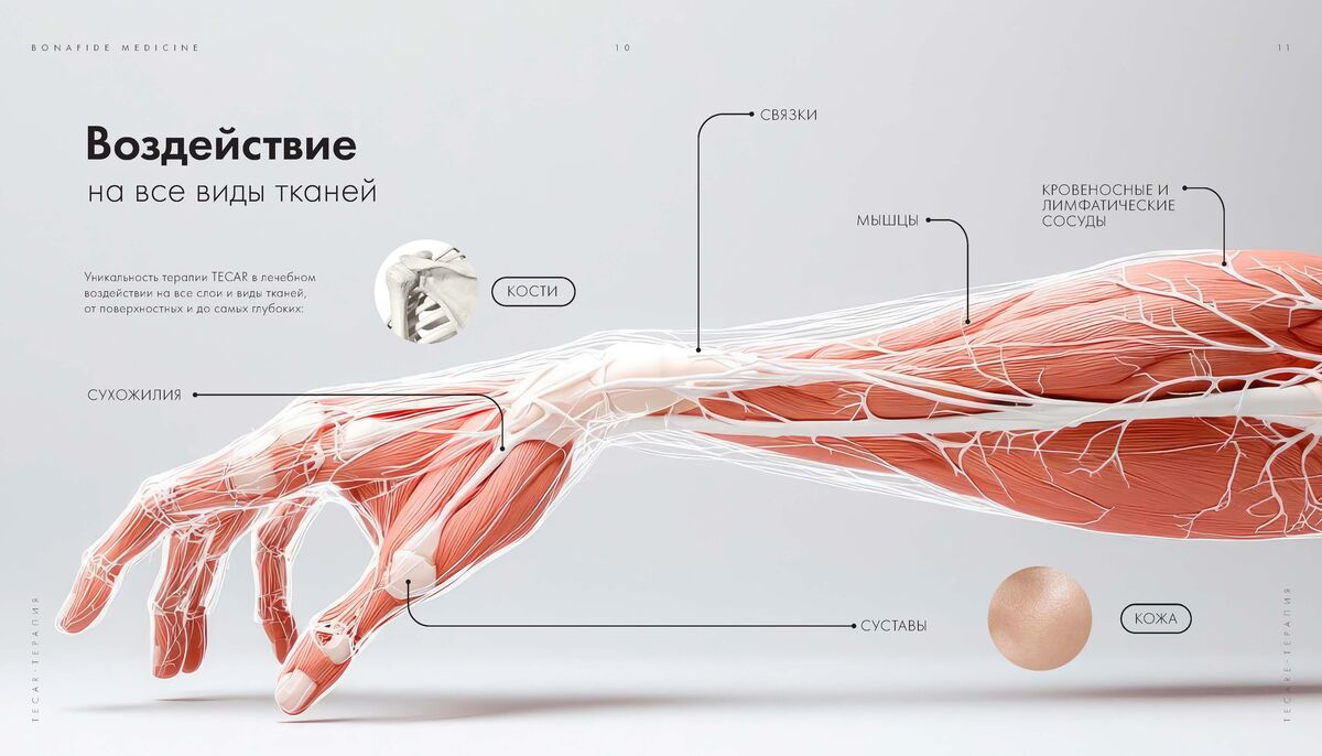 -#0010 {1200x686}: (tecar-1) [tecar-1]