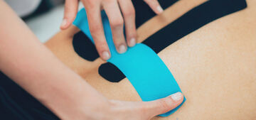 Кинезиотейпирование