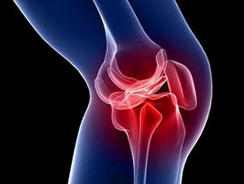 Повреждения коленного сустава